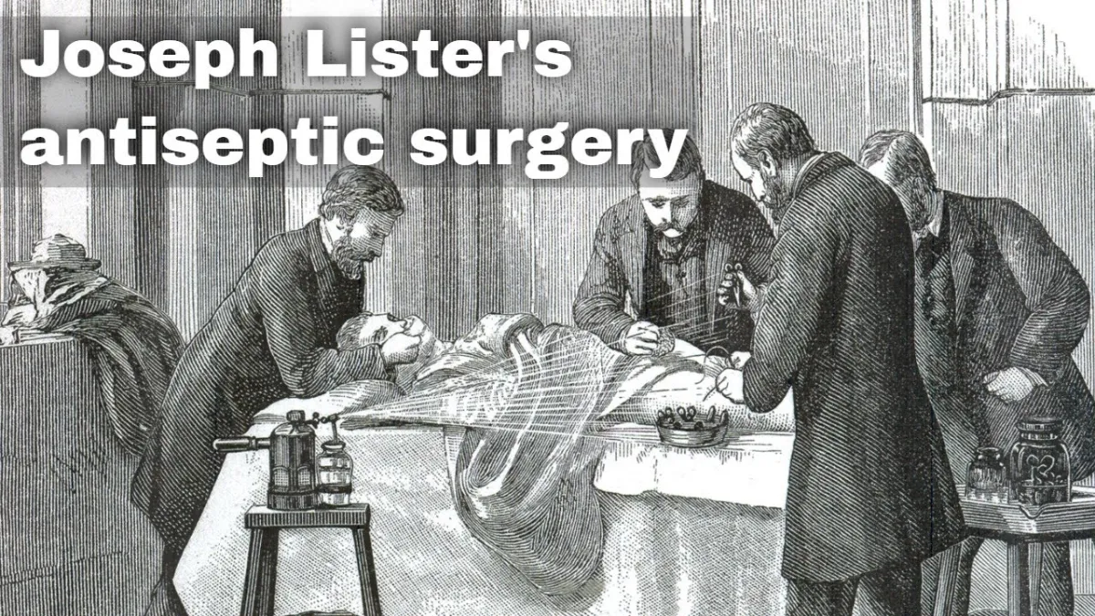 Joseph Lister